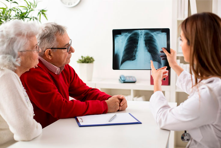 Um casal de terceira idade, recebendo informações sobre câncer de pulmão de uma médica